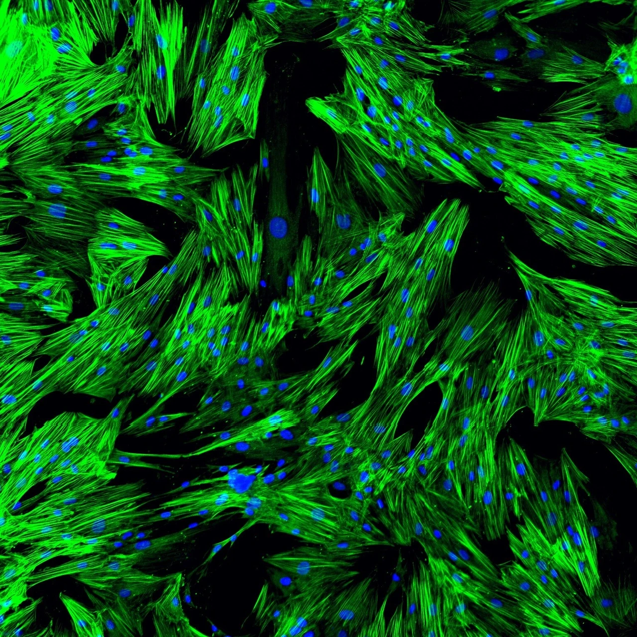In-vitro-Fibrosemodell