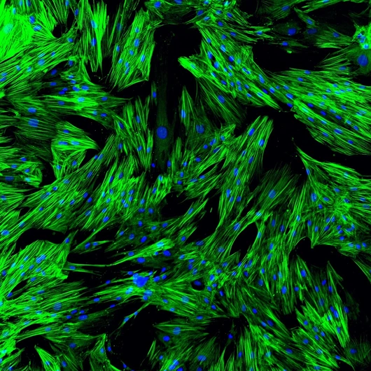 In-vitro-Fibrosemodell