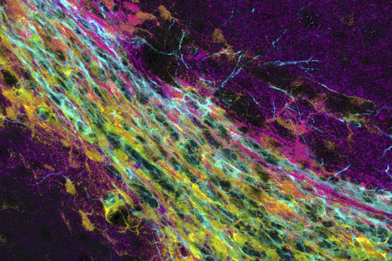 Neuronal progenitor cells travel from the subependymal zone to the olfactory bulb.