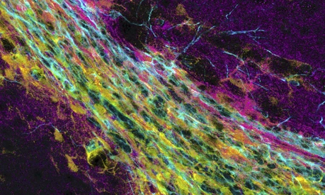 Neuronal progenitor cells travel from the subependymal zone to the olfactory bulb.