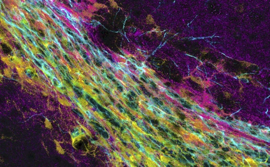 Neuronal progenitor cells travel from the subependymal zone to the olfactory bulb.