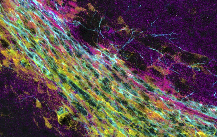 Neuronal progenitor cells travel from the subependymal zone to the olfactory bulb.
