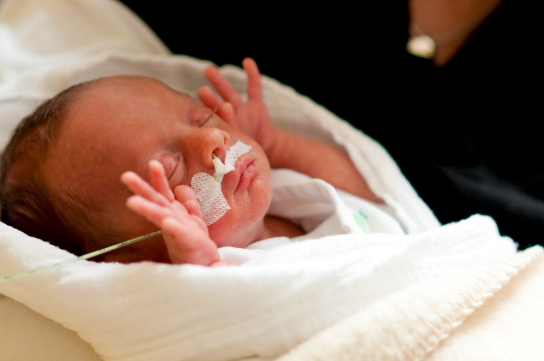 Hallo - Neugeborenes mit Beatmungsschlauch