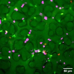 T-cells in the alveolar region