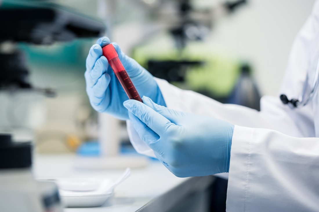 Scientist in biological lab holding blood test in hand