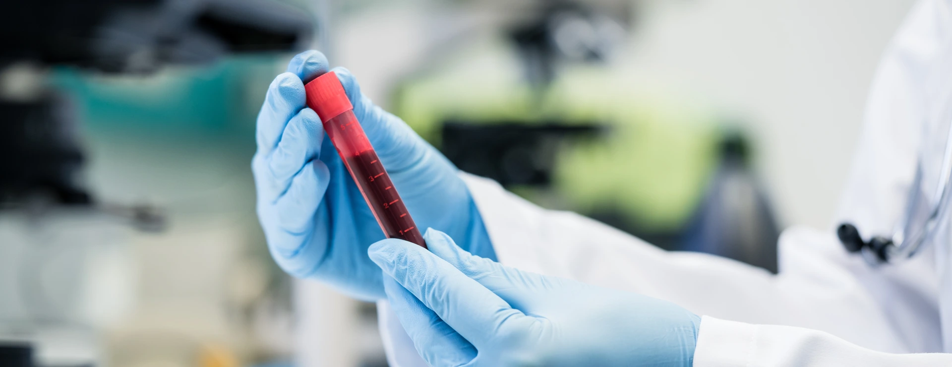 Scientist in biological lab holding blood test in hand