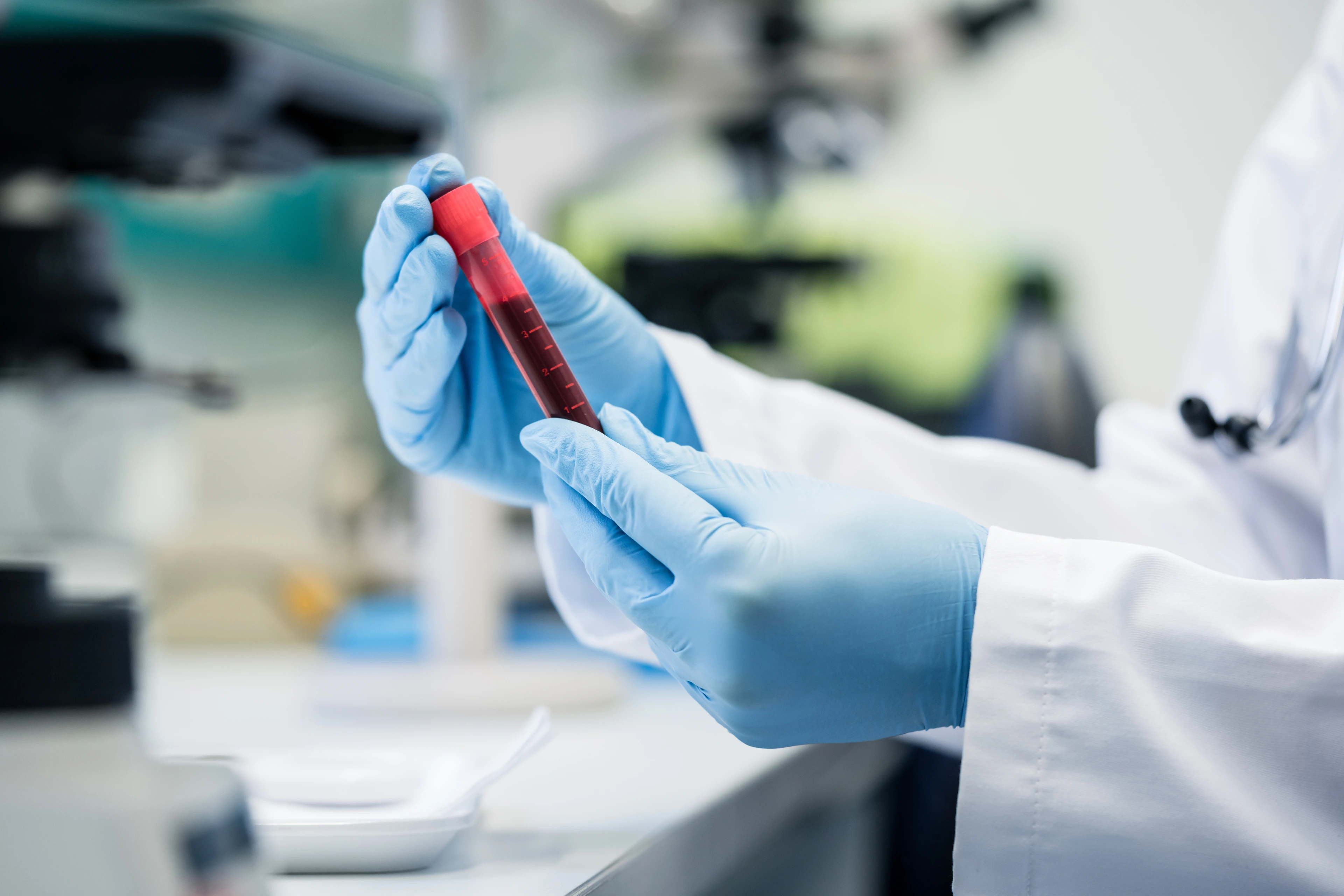 Scientist in biological lab holding blood test in hand