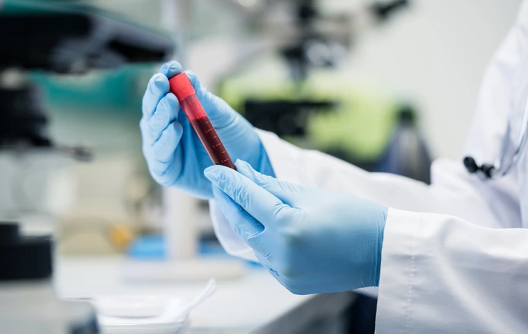 Scientist in biological lab holding blood test in hand