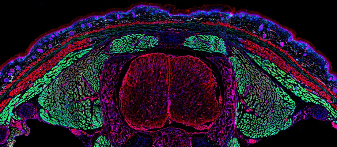 narbenbildende Fibroblasten grün in Mausembryo_Simon Christ