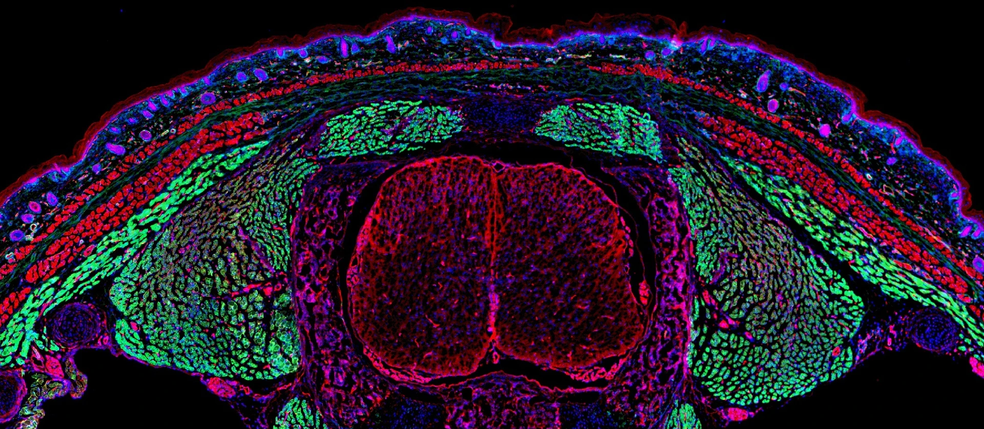 narbenbildende Fibroblasten grün in Mausembryo_Simon Christ