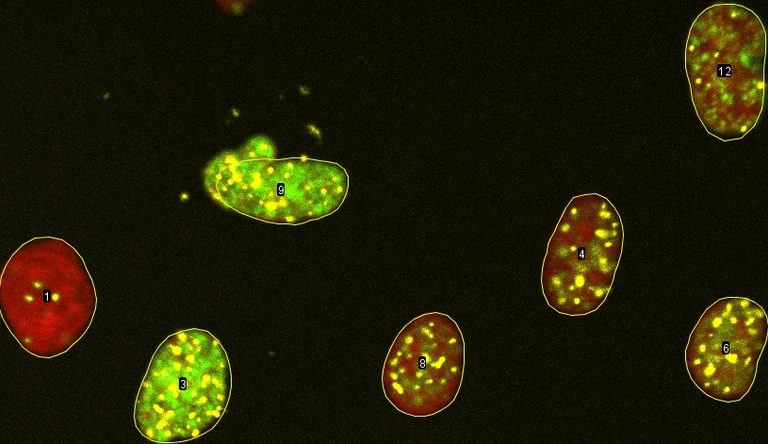 Transcription-Replication Conflicts under different temperatures