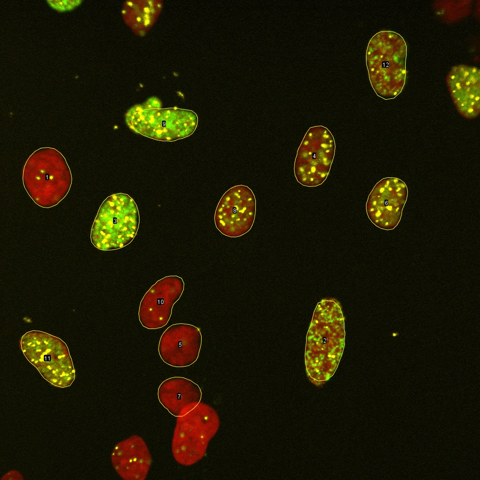 Transcription-Replication Conflicts under different temperatures