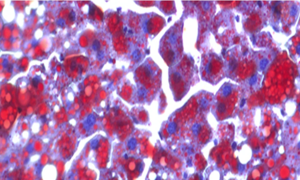 IDE - Institute for Diabetes and Endocrinology