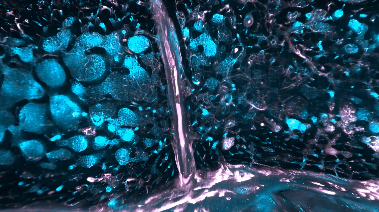 SMCs in human