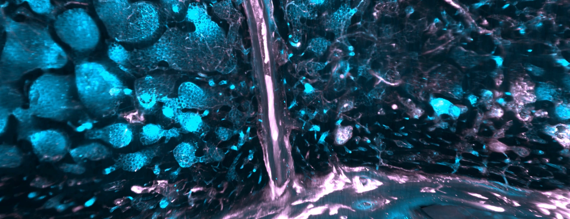 SMCs in human