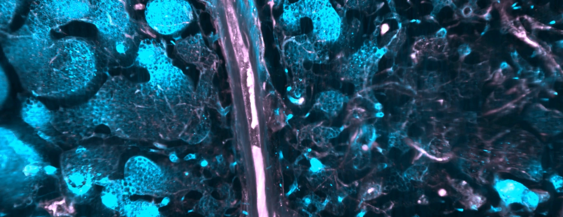 SMCs in human