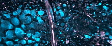 SMCs in human