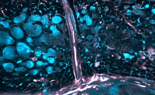 SMCs in human