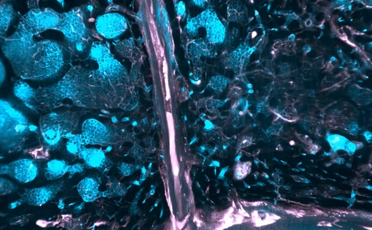 SMCs in human