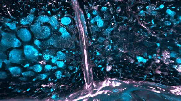 SMCs in human