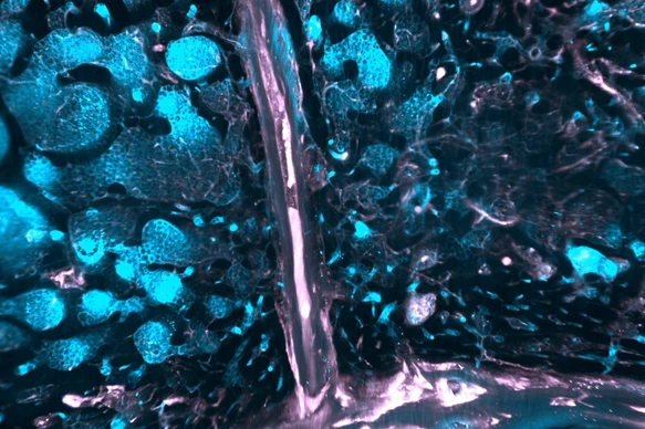 SMCs in human