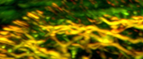 IBMI_Banner_nailfold