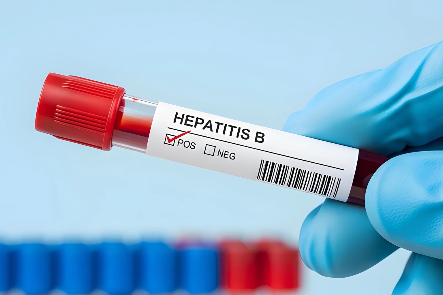 Hepatitis B blood sample