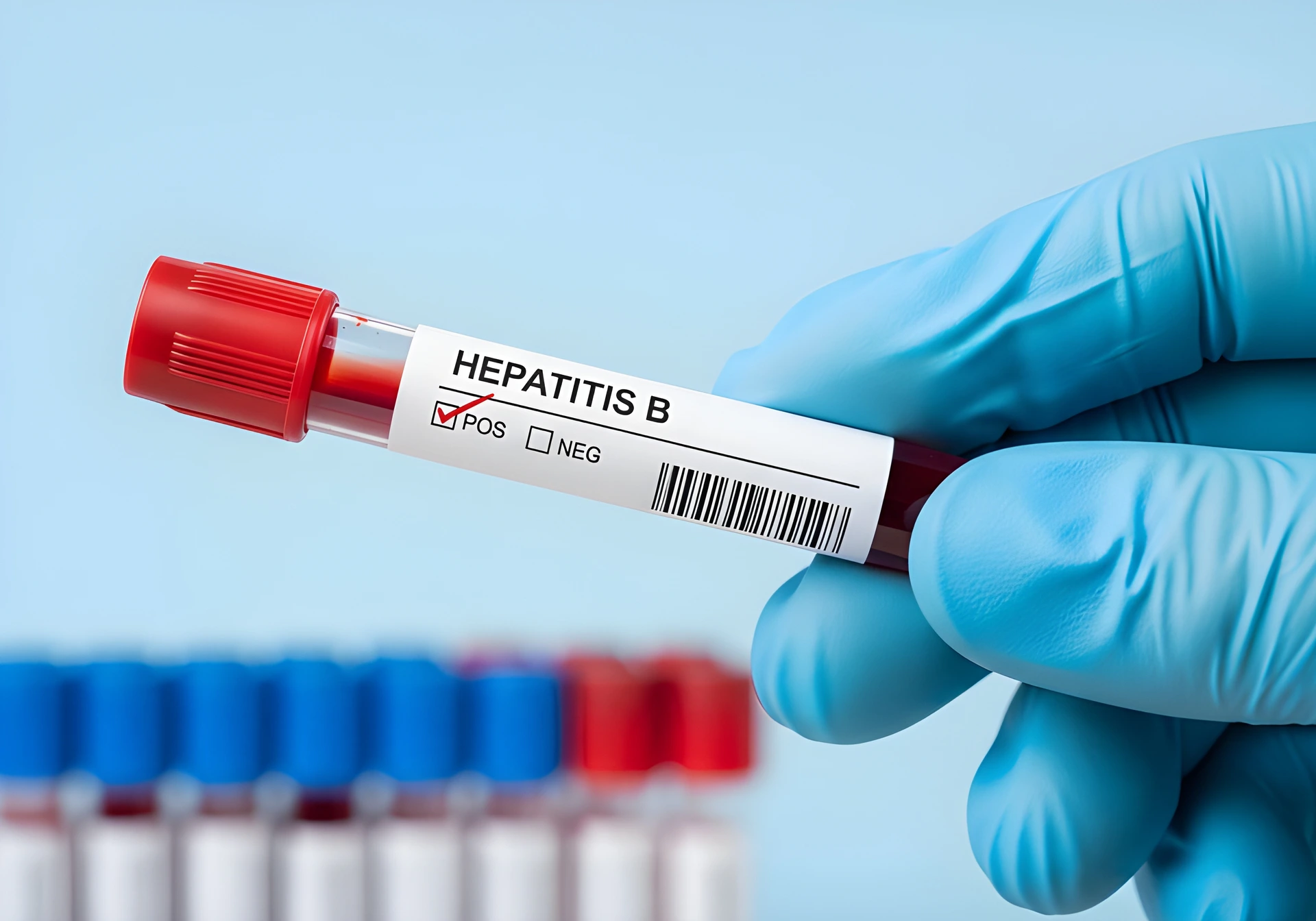 Hepatitis B blood sample