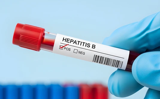Hepatitis B blood sample