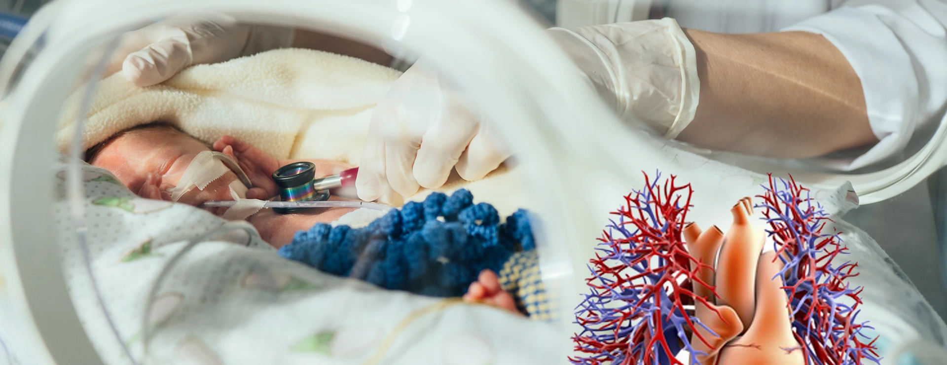 intensive care unit