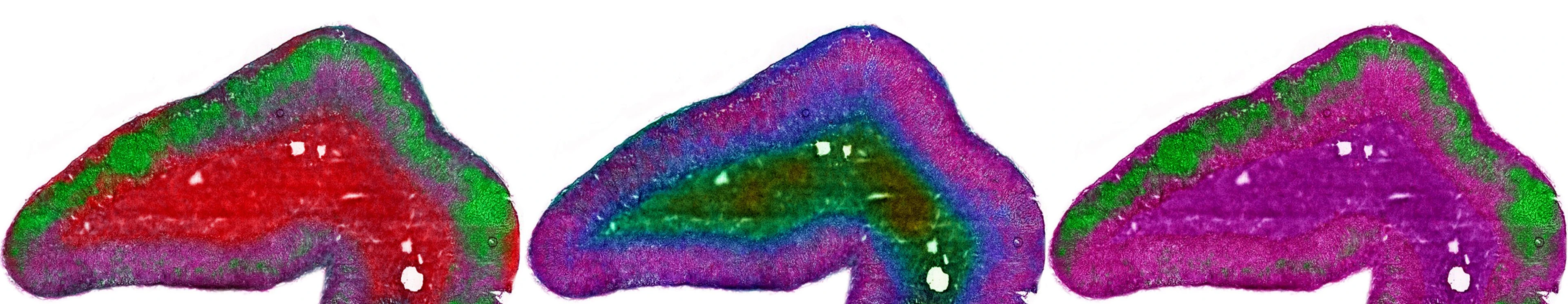 Nebenniere_Metabolite