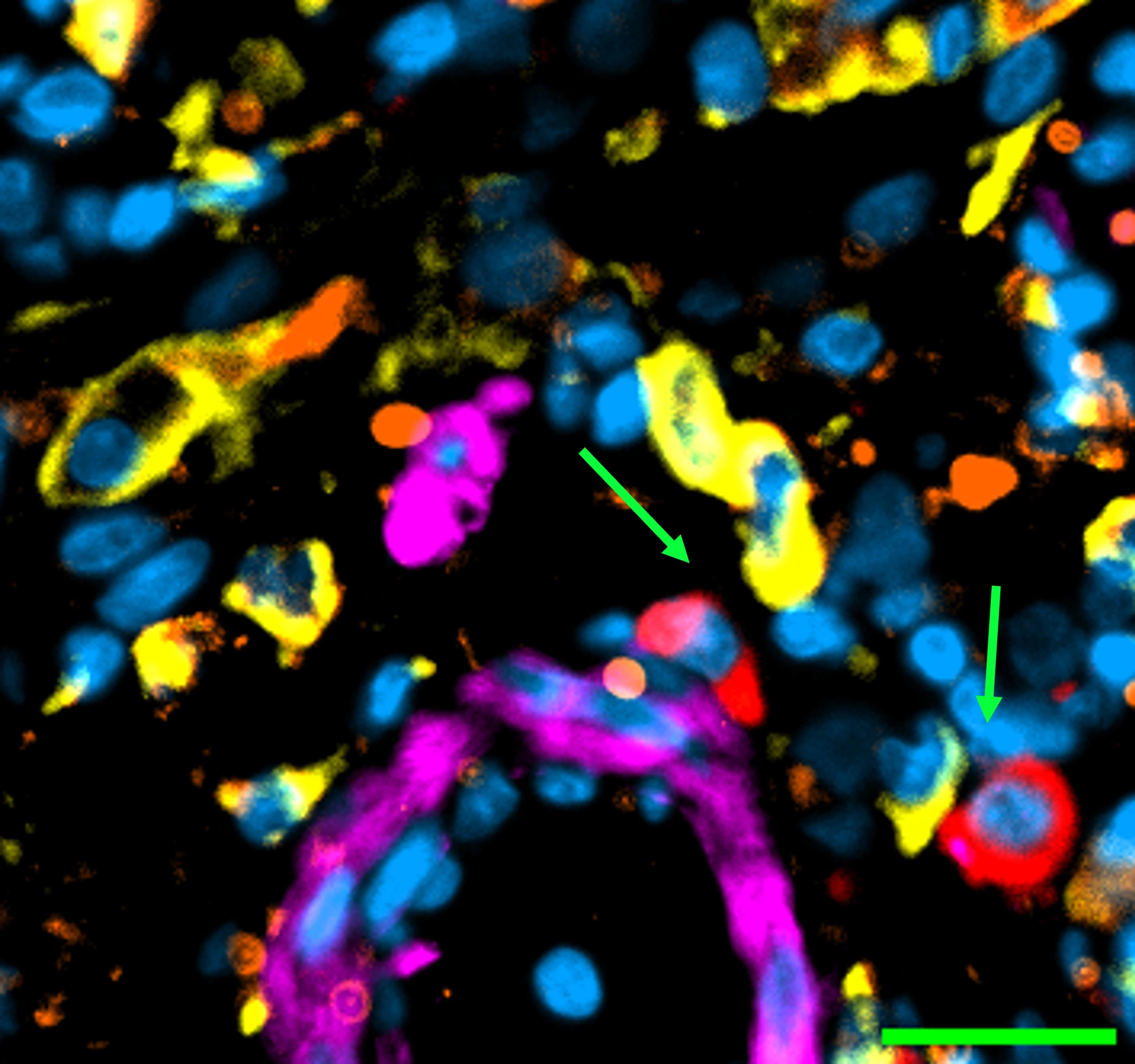 kapellos-lab-macrophages-fibrosis-lhi