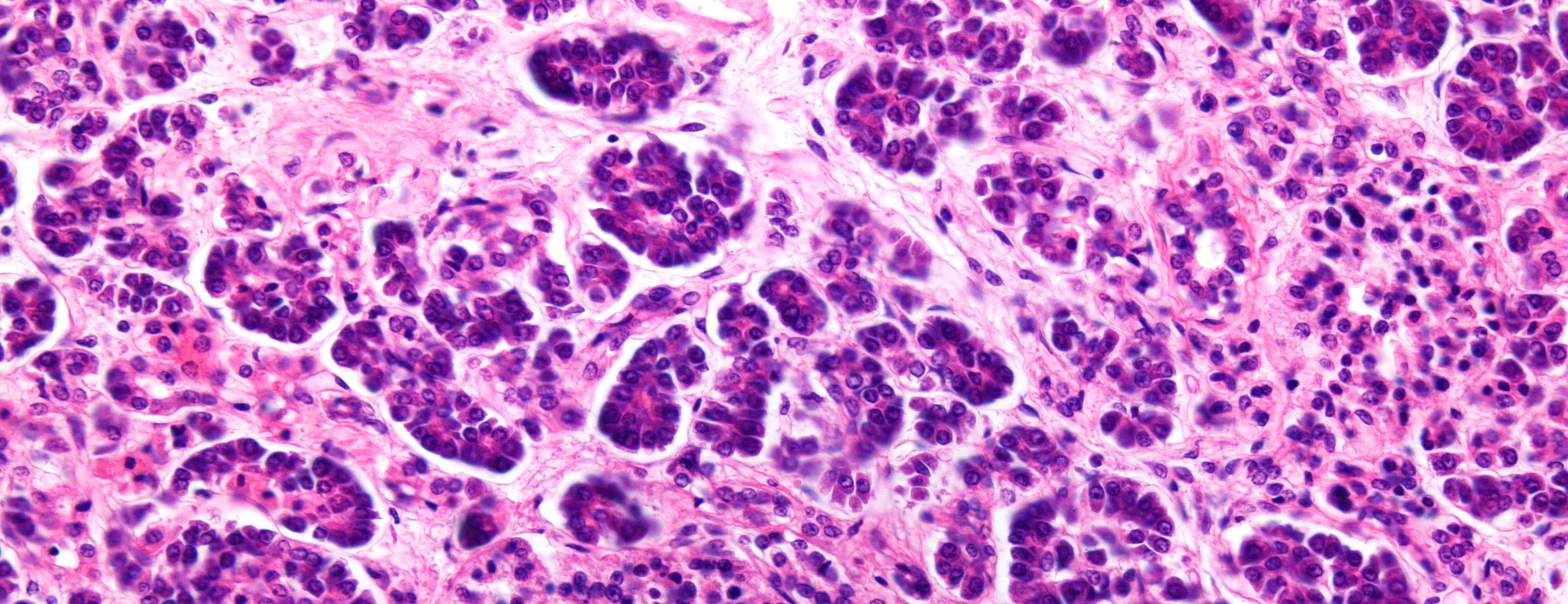 Human pancreas