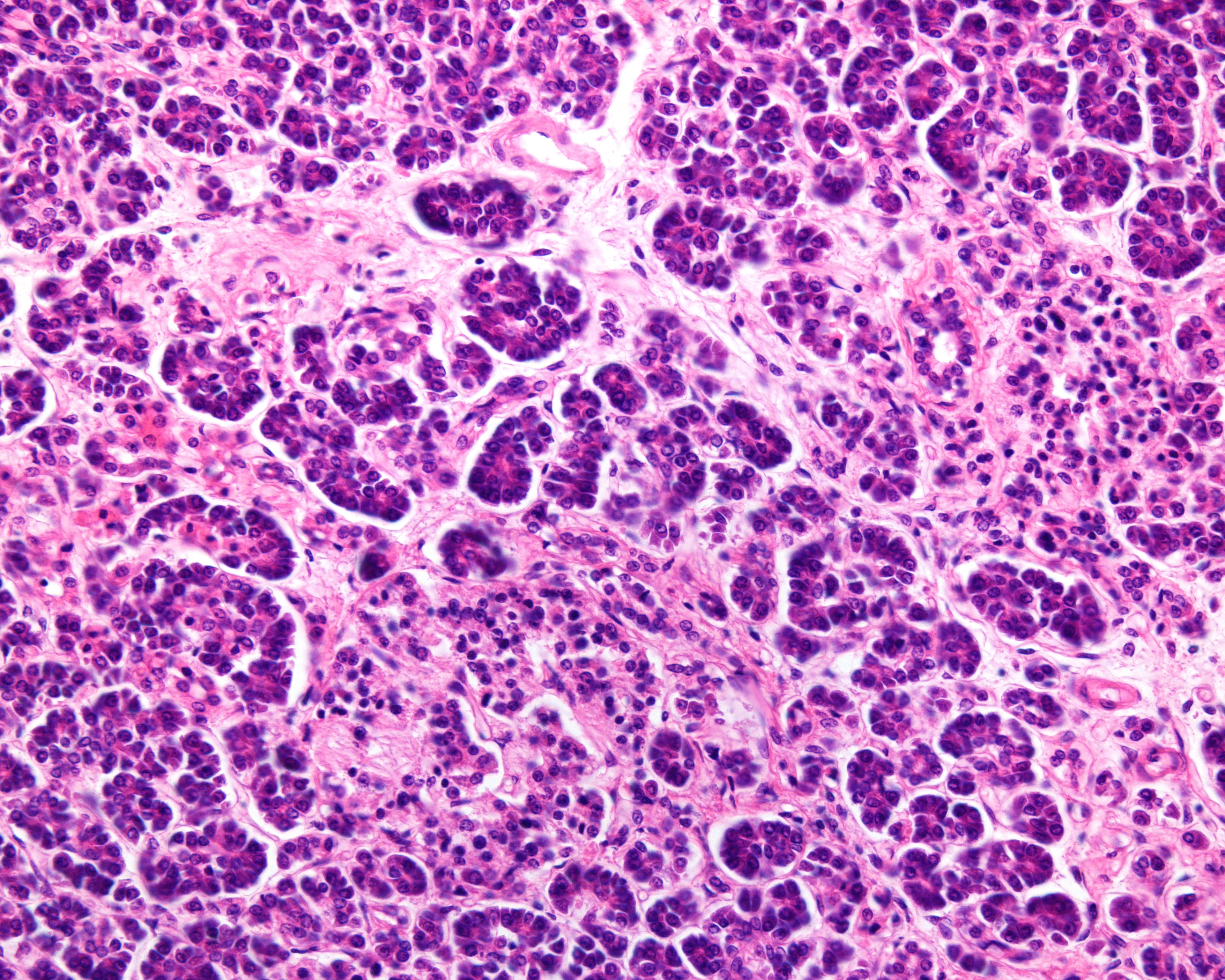 Human pancreas