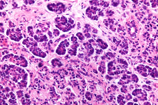 Human pancreas