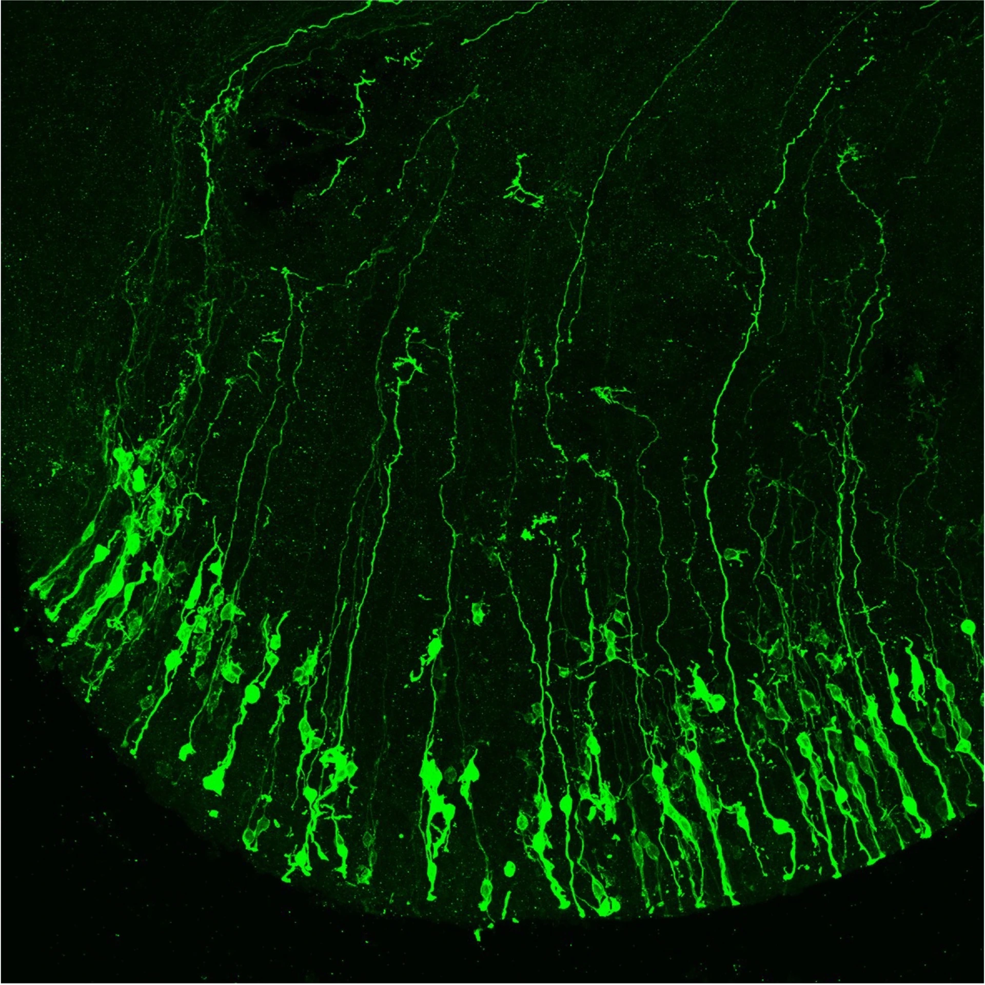 neural_stem_cells_1_isf