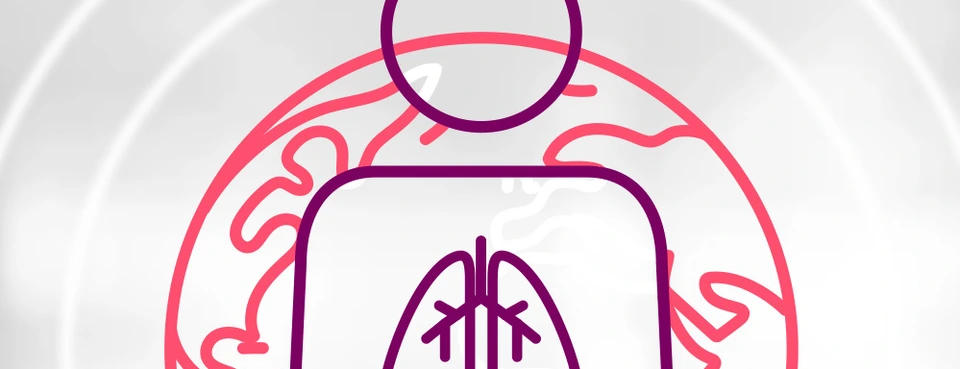 [Translate to German:] 