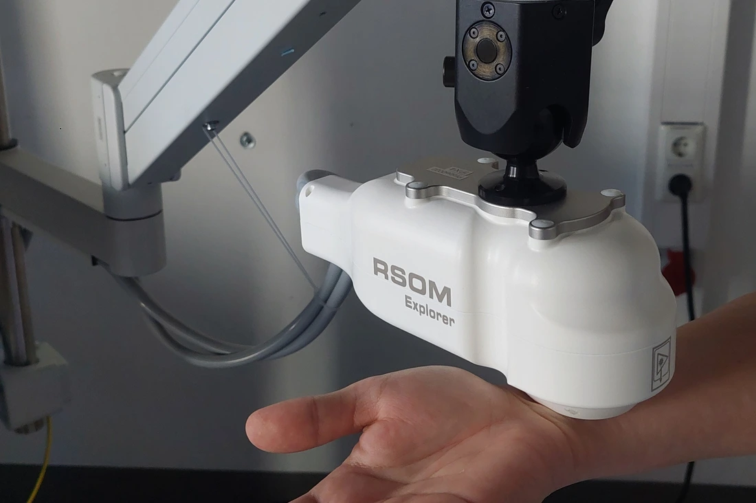 AI Skin Scanner examines a forearm