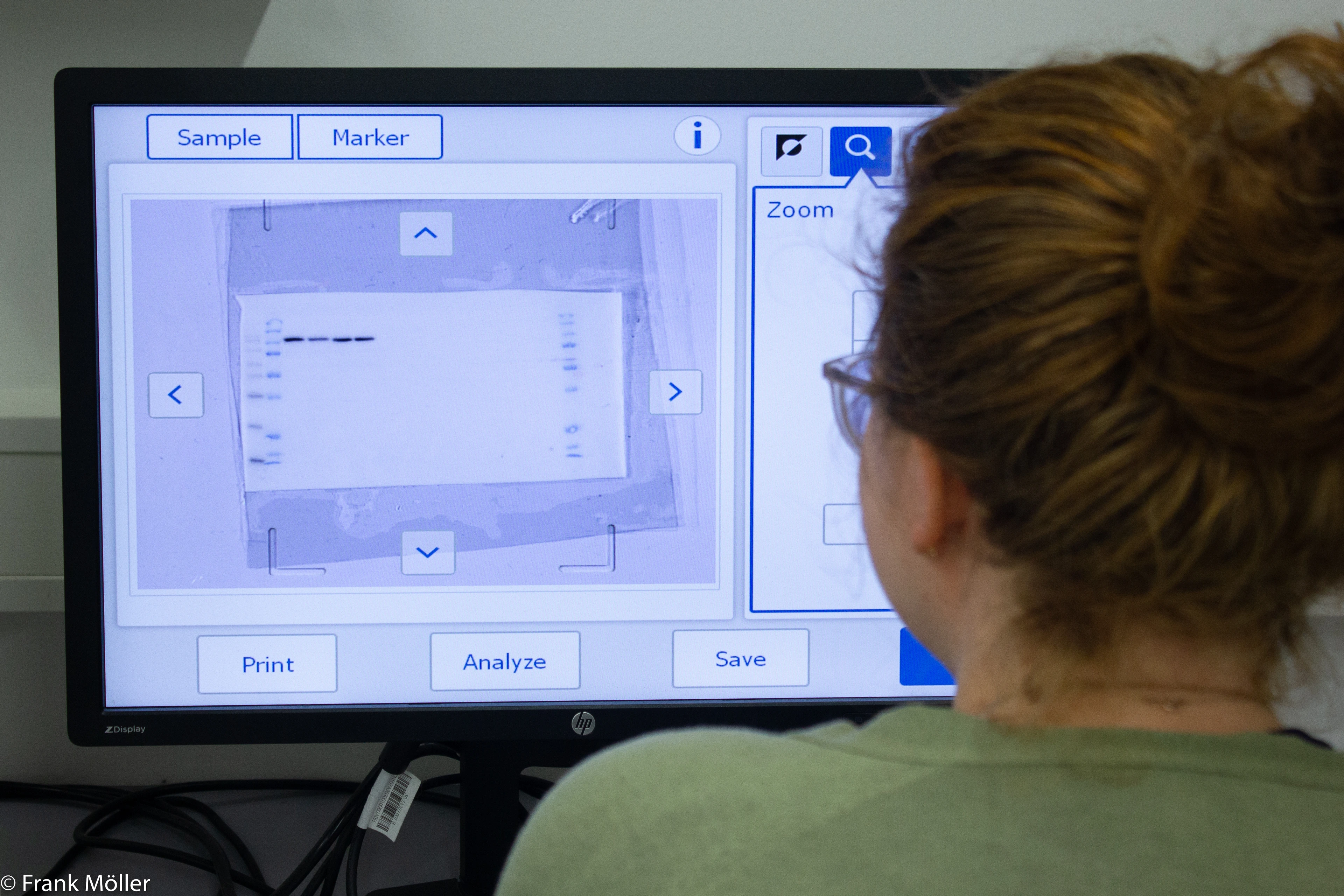 Western Blot Analysis (IMG_7224)