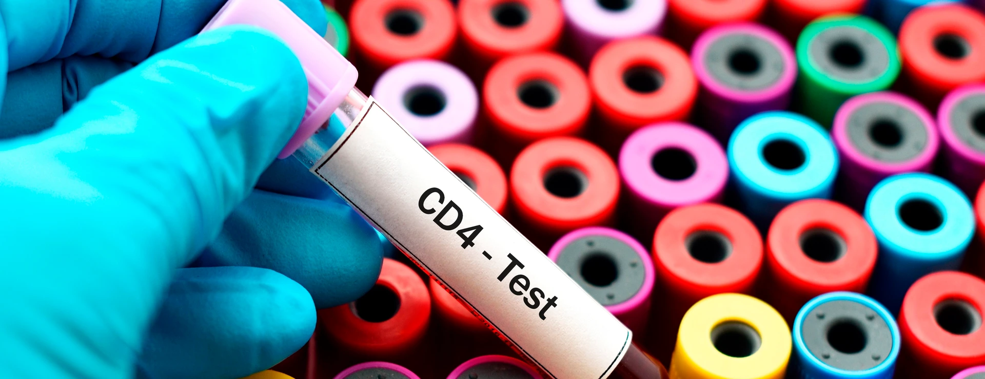Blood for CD4 test