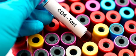 Blood for CD4 test