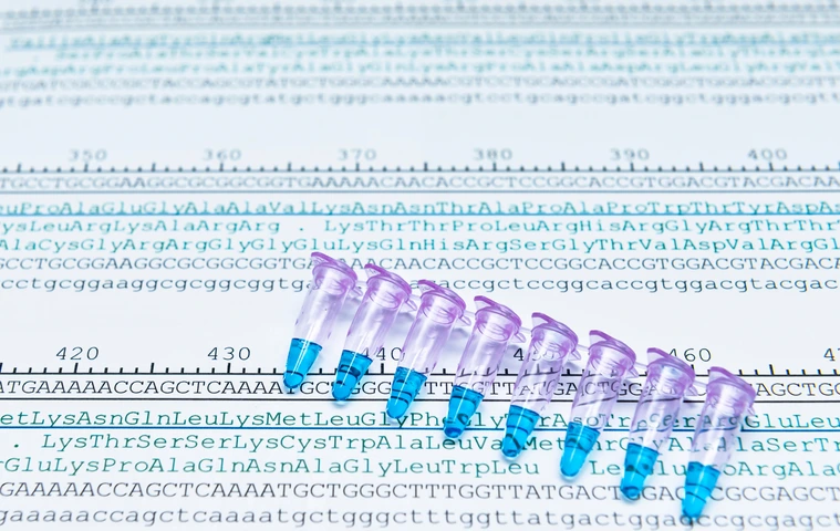 Protein sequencing by analysis of codon sequence of DNA