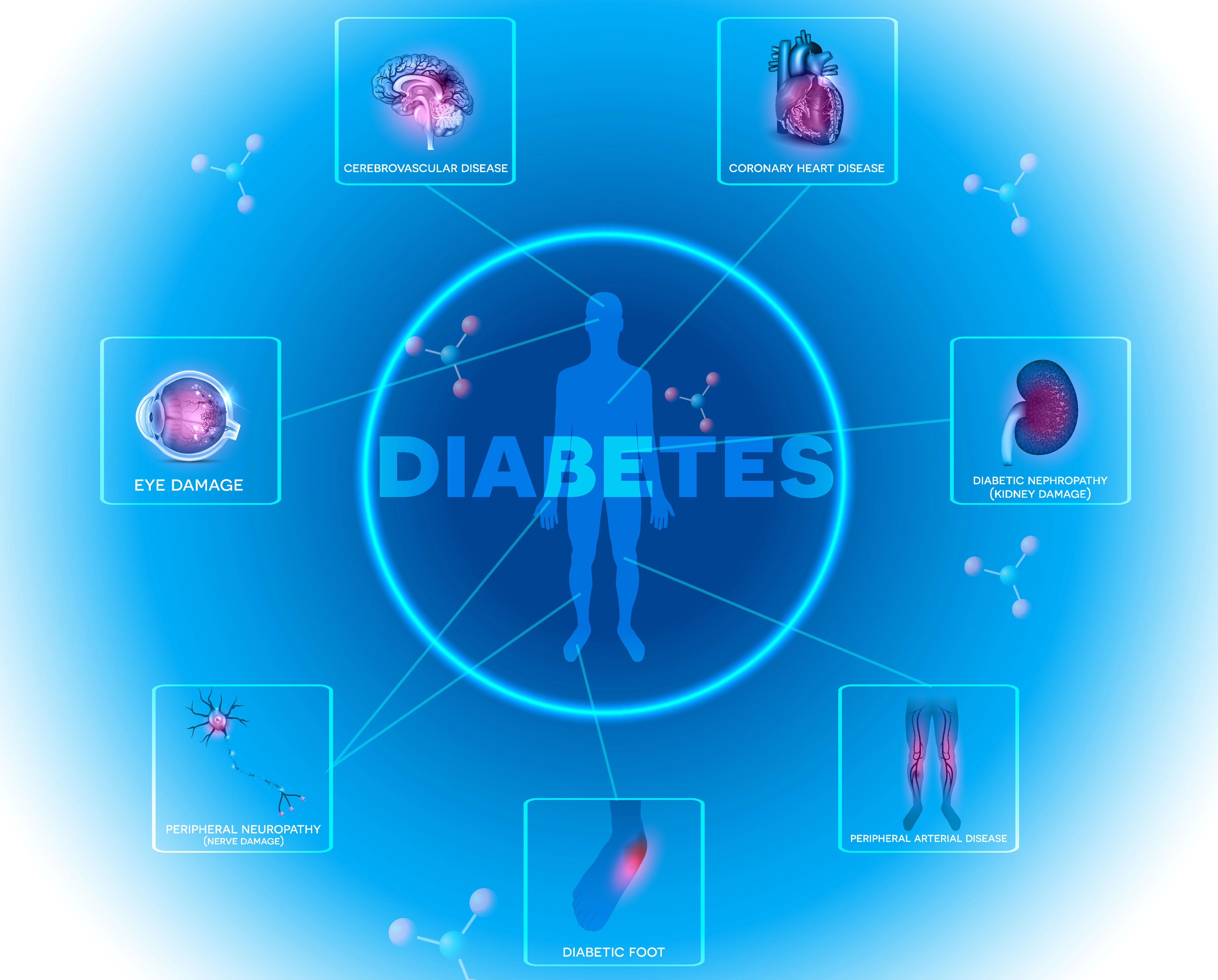 Diabetes affected organs