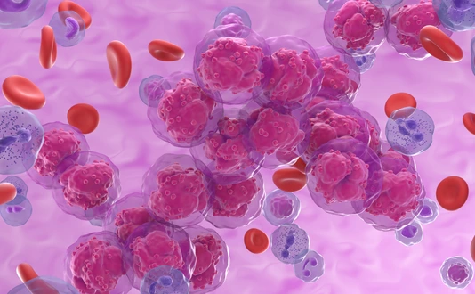 Leukemia cancer cells