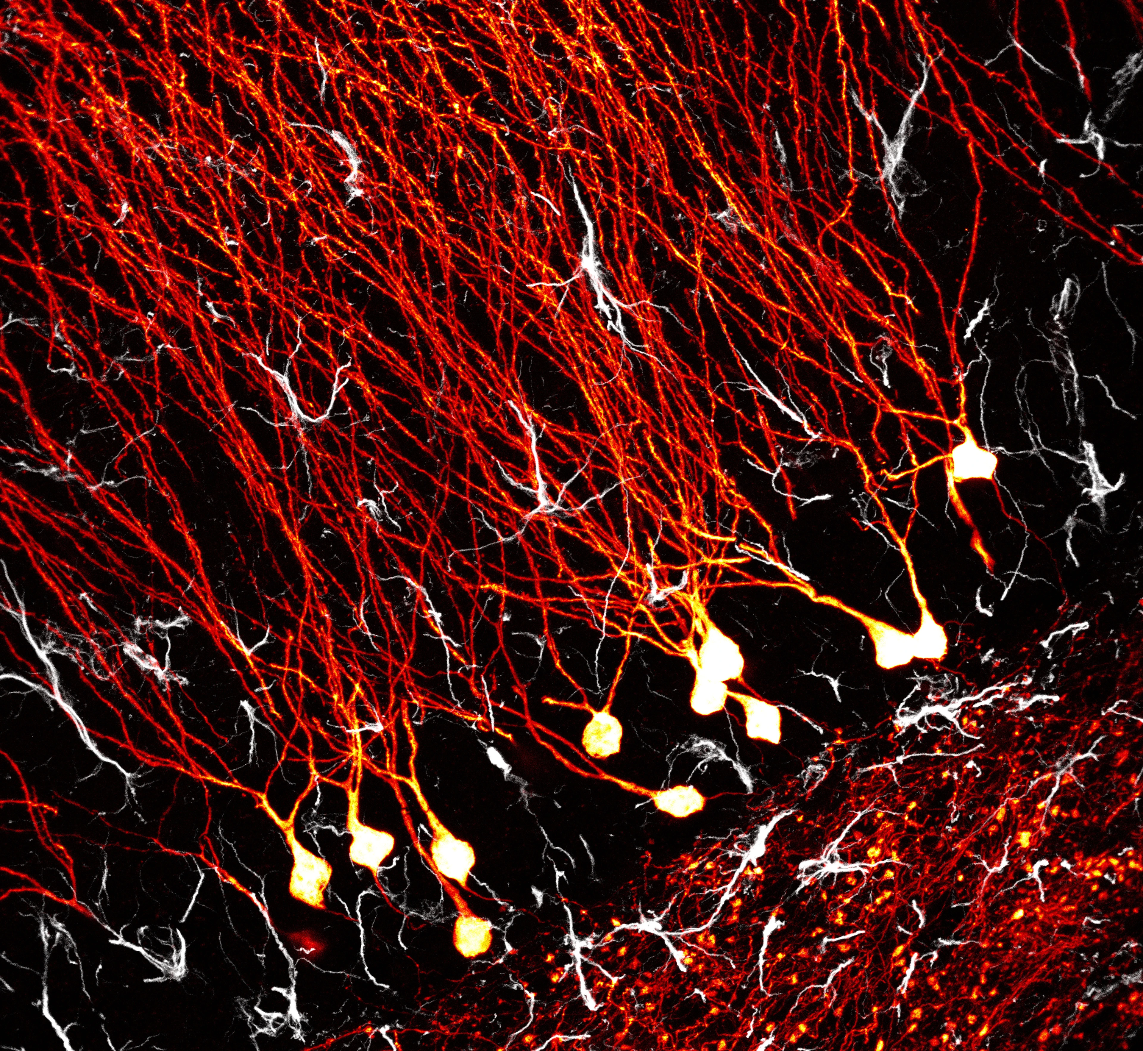 granule cell neurons