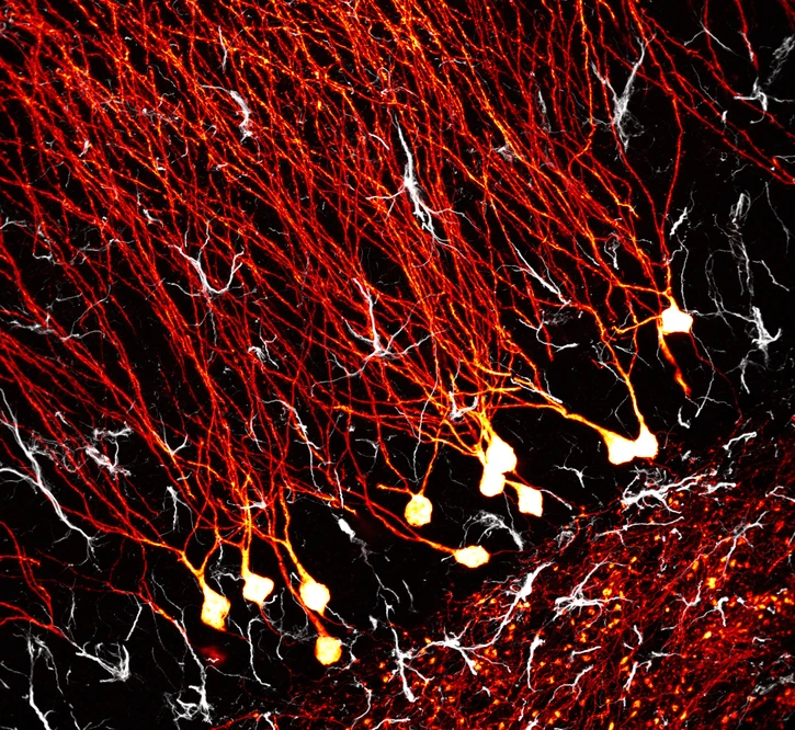 granule cell neurons