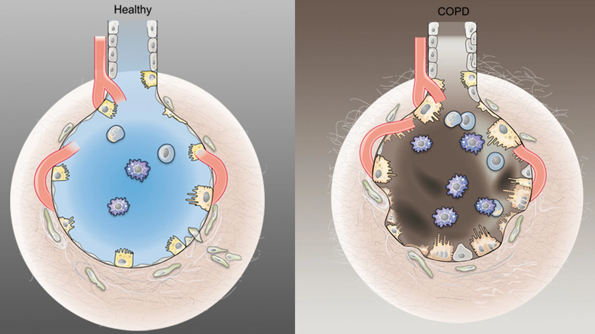 grafik_alveolen_healthy_copd_angelika_kramer