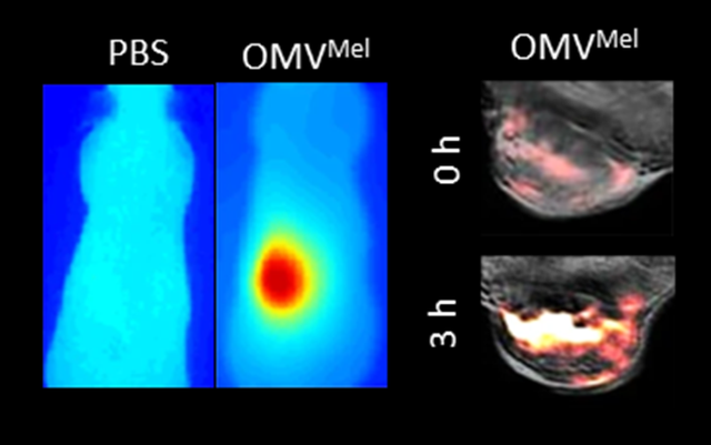 VGujrati Photo Therapy