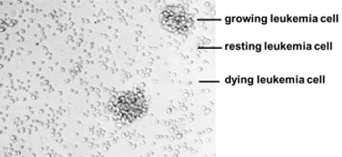 2_1_Induction_of_apoptosis_in_leukemia_1