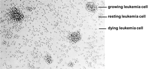 2_1_Induction_of_apoptosis_in_leukemia_1